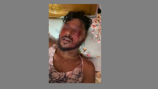 শীর্ষ সন্ত্রসী রাসেলের দু’চোখ উফরে ফেলা হয়েছে