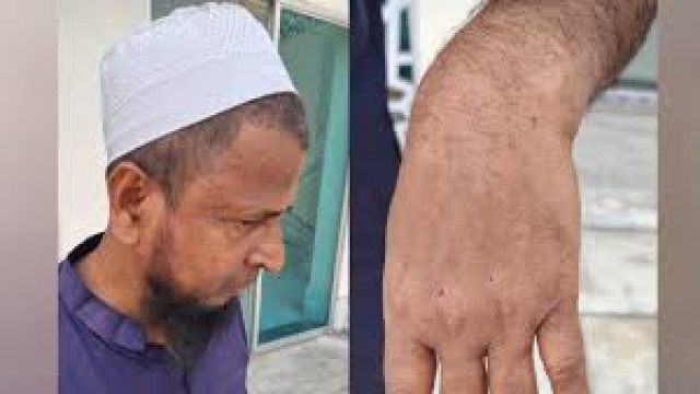 সোনারগাঁয়ে জামায়াতের নেতাকর্মীদের ওপর বিএনপির হামলা