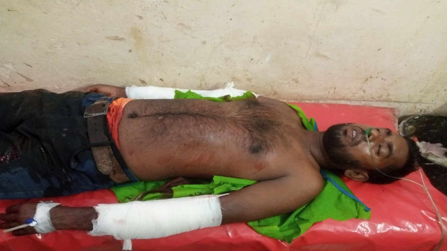 চাচাতো  ভাইদের ধারালো অস্ত্রের কোপে যুবক আহত।